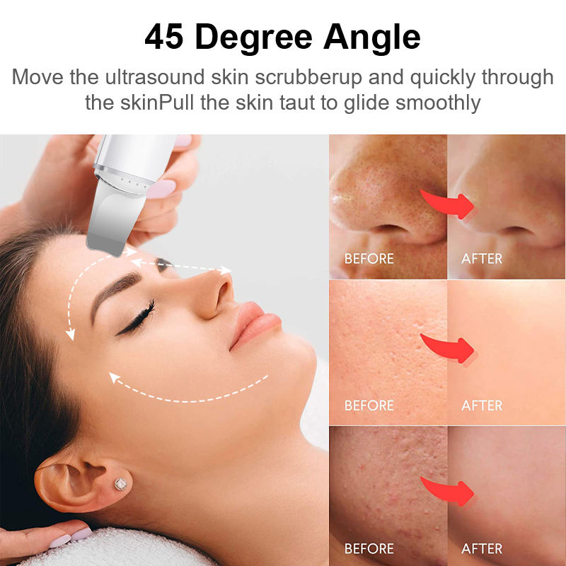 Ultrasonic Facial Skin Scrubber Deep Facial Cleaning